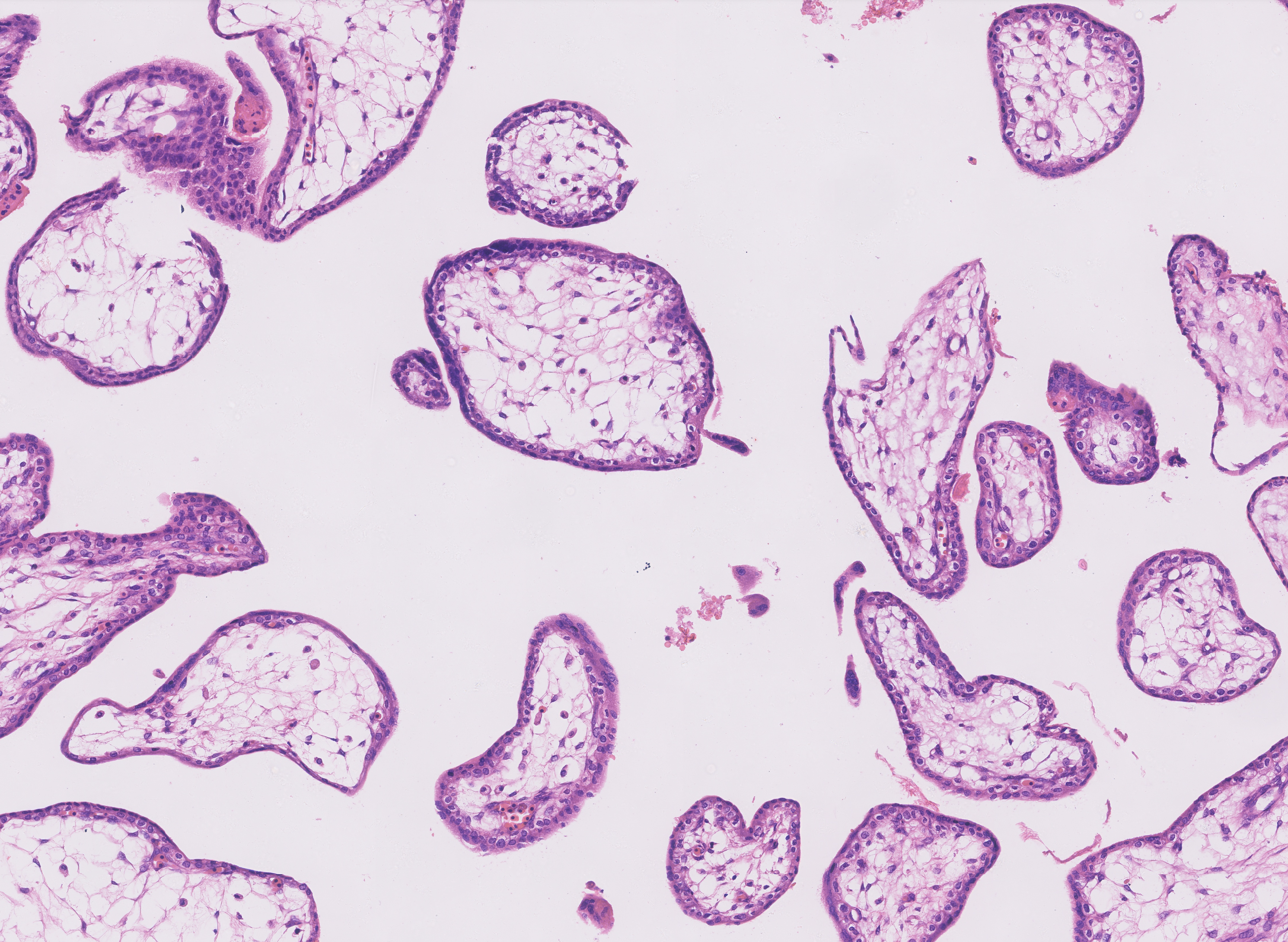Chorionic villi thumbnail